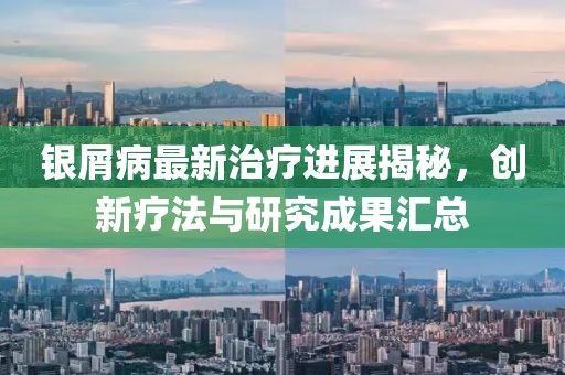 銀屑病最新治療進(jìn)展揭秘，創(chuàng)新療法與研究成果匯總